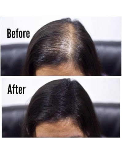 Topick Hair Building Fiber. (DARK BROWN) Restore Your Confidence with Thicker & Fuller Hairs. 27.5 G. Hair Volumizer (Dark Brown)
