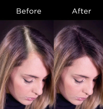 Topick Hair Building Fiber. (DARK BROWN) Restore Your Confidence with Thicker & Fuller Hairs. 27.5 G. Hair Volumizer (Dark Brown)