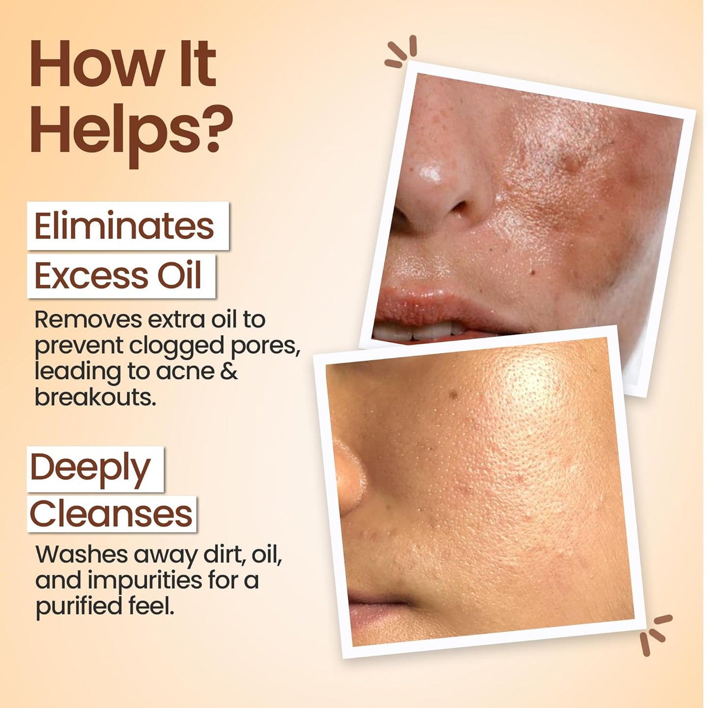 Herbs & Hills Multani Mitti Body Cleanser, Natural Exfoliating Soap with Aloe Vera, Turmeric & Red Sandalwood, 6x100g