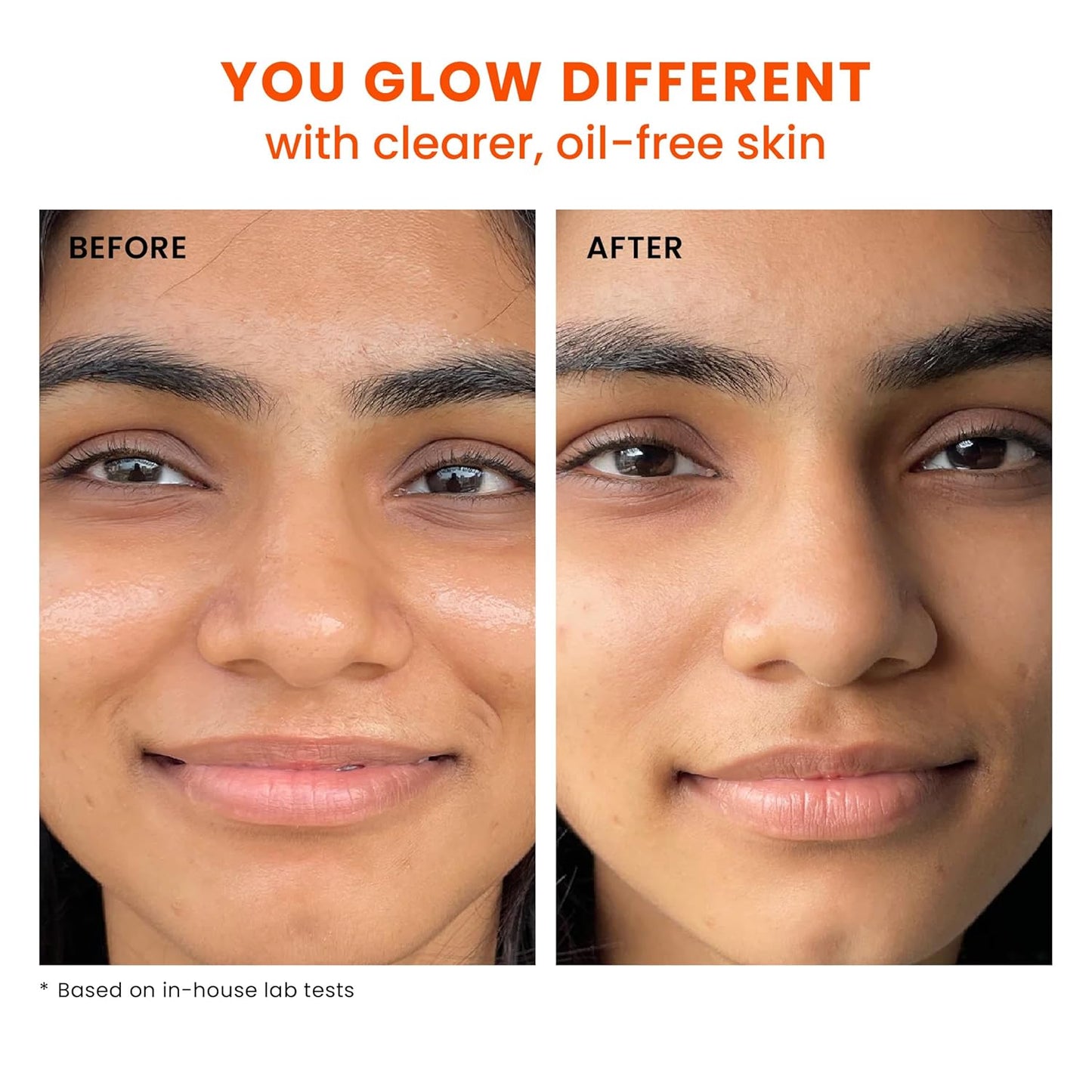 Foxtale SPF 70 Gel-Cream Sunscreen for Oily Skin | Oil Control Sunscreen with PA++++ & Niacinamide | UVA UVB Protection | Prevents Tan | Lightweight, Pore-minimising, No White Cast | 50ml