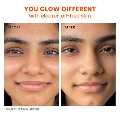 Foxtale SPF 70 Gel-Cream Sunscreen for Oily Skin | Oil Control Sunscreen with PA++++ & Niacinamide | UVA UVB Protection | Prevents Tan | Lightweight, Pore-minimising, No White Cast | 50ml