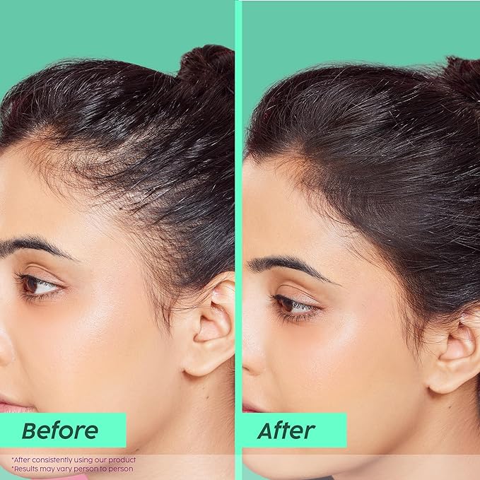 Plix Rosemary Advanced Anti HairFall Shampoo for Decreases Hair Fall & Breakage - 200 ml