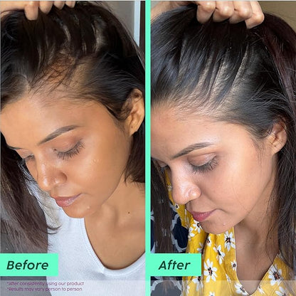 Plix Rosemary Advanced Anti HairFall Shampoo for Decreases Hair Fall & Breakage - 200 ml